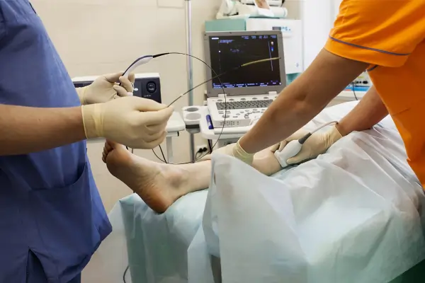 treatmentforvaricoseveins